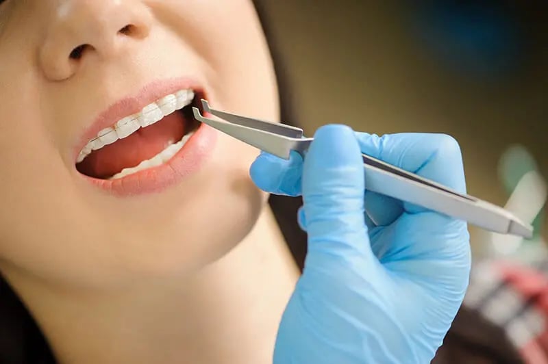 Desarrolla tus conocimientos en el manejo de aparatos de ortodoncia en esta especialidad.